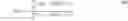 Fig. 49 - Methods and systems to remove particle-motion-sensor noise from vertical-velocity data
