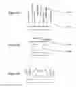 Fig. 07 - Method and apparatus for ophthalmic devices including gradient-indexed and shaped liquid crystal layers