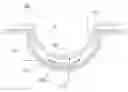 Fig. 01 - VARIABLE OPTIC OPHTHALMIC DEVICE INCLUDING LIQUID CRYSTAL ELEMENTS