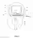 Fig. 02 - Fixing device