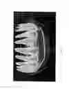 Fig. 04 - System and Method for Customized Anatomical Implant Prosthetic Pieces