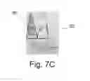 Fig. 12 - System and Method for Customized Anatomical Implant Prosthetic Pieces