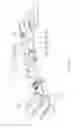 Fig. 04 - Adjustable docking device and display device therewith