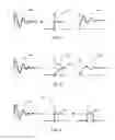 Fig. 05 - Mitigation of power supply disturbance for wired-line transmitters