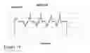 Fig. 18 - NANOWIRE ENABLED PAPER BASED HAPTIC INTERFACES