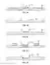 Fig. 04 - Instrument detection with an optical touch sensitive device