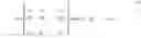 Fig. 04 - Lee metric error correcting code