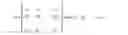 Fig. 15 - Lee metric error correcting code