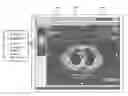Fig. 01 - Image visualization of medical imaging studies between separate and distinct computing system using a template