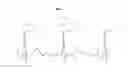 Fig. 04 - User authentication method and apparatus based on electrocardiogram (ECG) signal