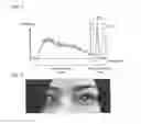 Fig. 04 - Image processing device and image processing method