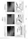 Fig. 15 - Analyzing a skin condition from a video