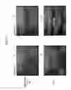 Fig. 17 - Analyzing a skin condition from a video