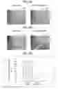 Fig. 19 - Analyzing a skin condition from a video