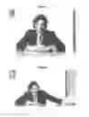 Fig. 03 - Electronic boss