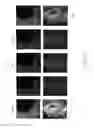 Fig. 08 - Virtual spatial overlap modulation microscopy for resolution improvement