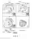 Fig. 14 - Medical image processing apparatus and a medical image processing method