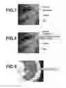Fig. 06 - Medical image measuring apparatus, method, and medium