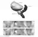 Fig. 01 - Systems and methods for segmenting medical images based on anatomical landmark-based features