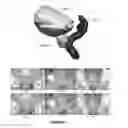 Fig. 02 - Systems and methods for segmenting medical images based on anatomical landmark-based features