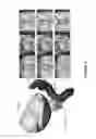 Fig. 09 - Systems and methods for segmenting medical images based on anatomical landmark-based features
