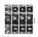 Fig. 11 - Systems and methods for segmenting medical images based on anatomical landmark-based features