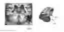 Fig. 01 - Model-based segmentation of an anatomical structure