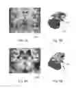 Fig. 04 - Model-based segmentation of an anatomical structure