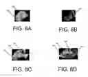 Fig. 09 - Automated food recognition and nutritional estimation with a personal mobile electronic device