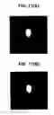 Fig. 16 - Method and apparatus for estimating scatter in a positron emission tomography scan at multiple bed positions