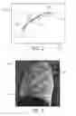 Fig. 04 - Delineation and/or correction of a smooth stiff line in connection with an independent background image