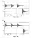 Fig. 03 - Beat synchronization in a game