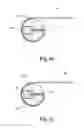 Fig. 34 - Stringed instrument system