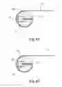 Fig. 34 - Stringed instrument system
