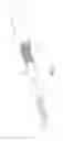 Fig. 05 - Triple helix driveline cable and methods of assembly and use