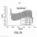 Fig. 11 - Undulator with dynamic compensation of magnetic forces