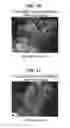 Fig. 12 - Electron microscope and sample observation method