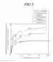 Fig. 08 - Etching method