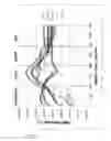 Fig. 09 - BACK CONTACT SUBSTRATE FOR A PHOTOVOLTAIC CELL OR MODULE