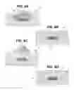 Fig. 11 - Packaging for Ultraviolet Optoelectronic Device