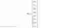 Fig. 15 - Displacement devices and methods for fabrication, use and control of same