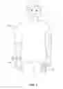 Fig. 04 - Camera remote control