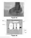 Fig. 10 - Modification of post-viewing parameters for digital images using image region or feature information
