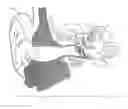 Fig. 01 - Hearing system having improved high frequency response