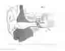 Fig. 02 - Hearing system having improved high frequency response