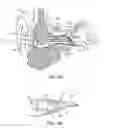 Fig. 05 - Hearing system having improved high frequency response