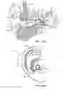 Fig. 07 - Hearing system having improved high frequency response