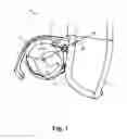 Fig. 02 - Hearing device with closure mechanism