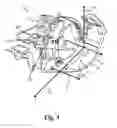 Fig. 04 - Hearing device with closure mechanism
