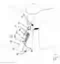 Fig. 03 - IMPLANTABLE HEARING AID